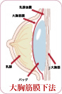 �勹�ؖ����@|�L�� �p 