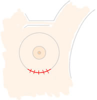 ���[�����؊J�@|�L�� �p 