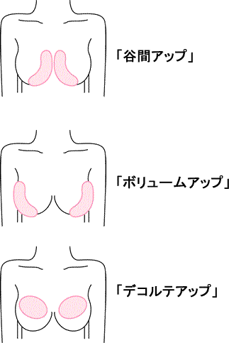 �o�X�g�A�b�v����������`|�L�� �p