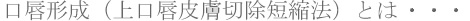 ���O�`��(����O�畆�؏��Z�k�@)�Ƃ�|���O(�����т�)�̐��`