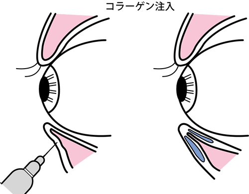 �ܑ�(�ڑ�)