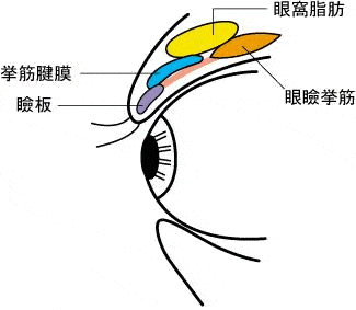 挙筋短縮法1