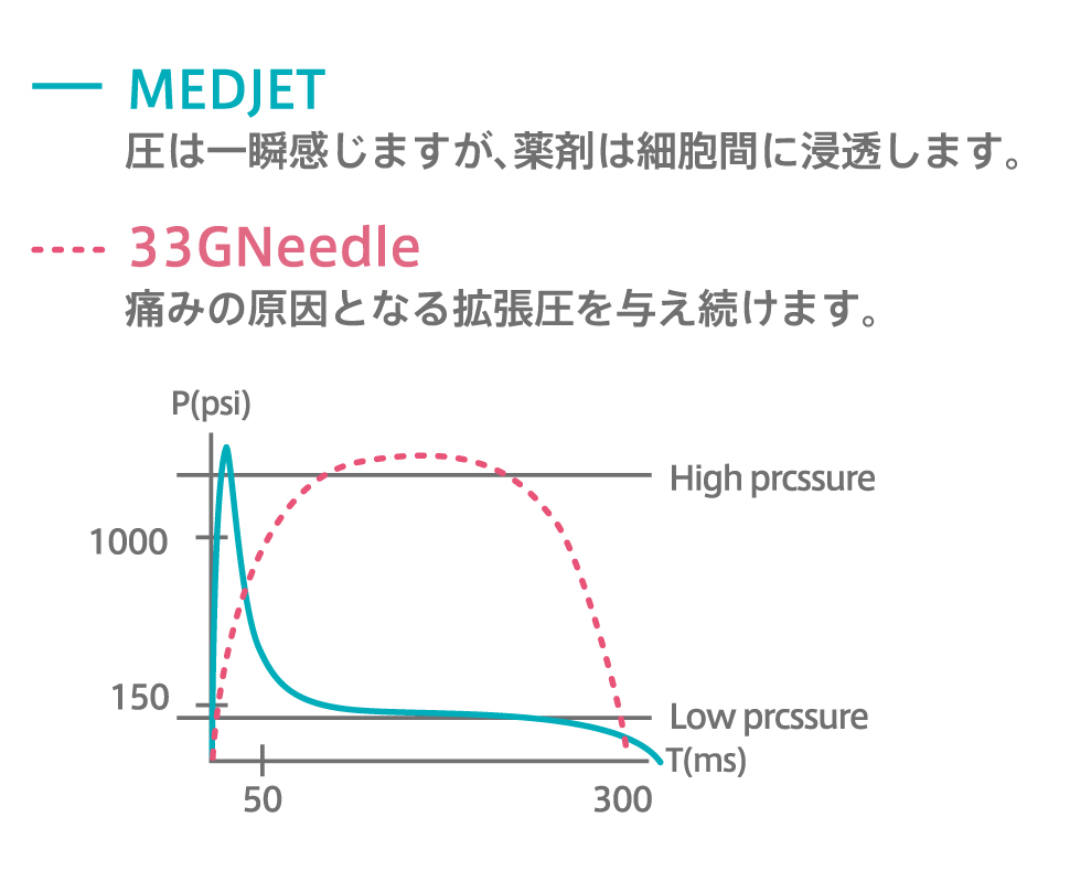 33G針とMEDJETの拡張の拡張圧の違い