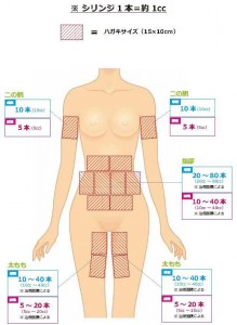 注入箇所