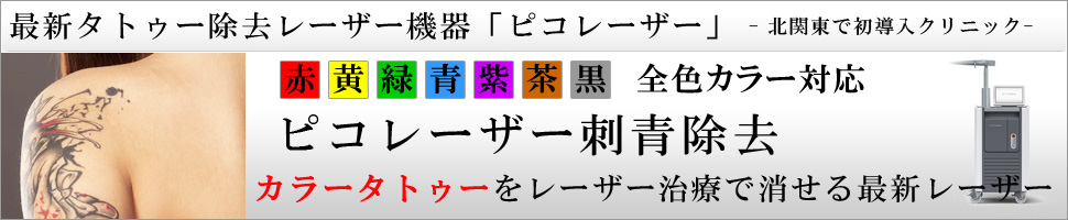 ピコレーザー刺青除去