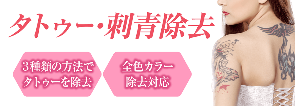 タトゥー・刺青除去