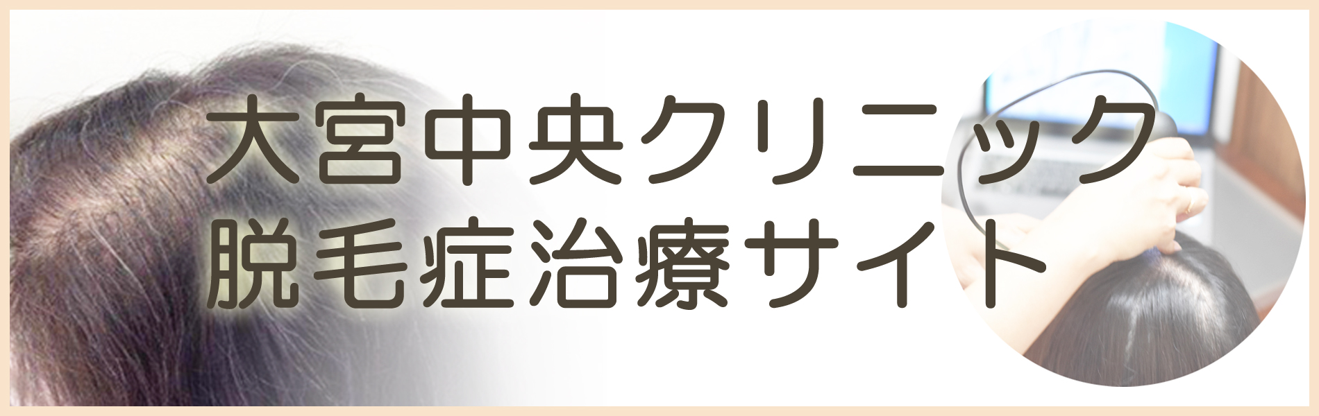 大宮中央クリニック脱毛症治療サイト