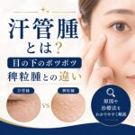 汗管腫とは？目の下の小さなポツポツとレーザー治療について