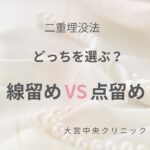 二重埋没法 線留めと点留めの違いを解説 大宮中央クリニック