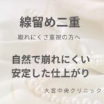 線留め二重（シルクライン法）の特徴とメリットを解説する大宮中央クリニックのページ