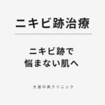 ニキビ跡治療は原因が違えば治療も違う｜大宮中央クリニック