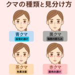 クマの種類と見分け方｜青クマ・黒クマ・茶クマ・赤クマの違いと原因・治療法