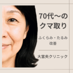 70代〜のクマ取り（ふくらみ・たるみ改善）のアイキャッチ画像｜大宮中央クリニック
