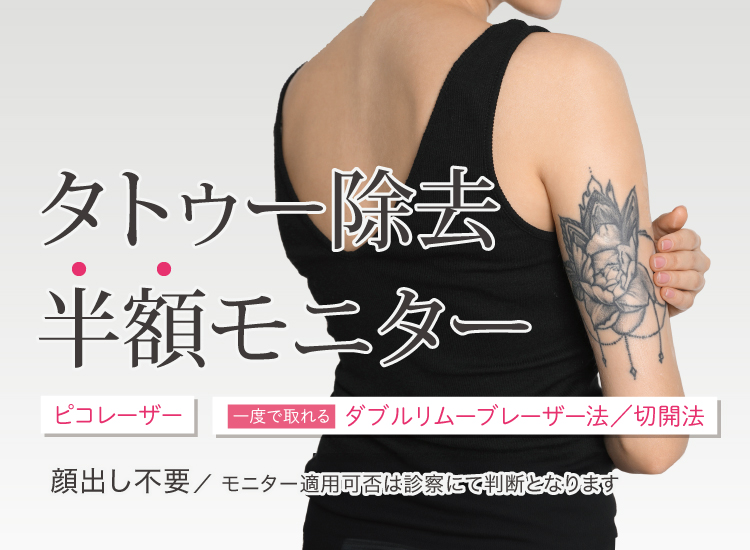 タトゥー除去半額モニター