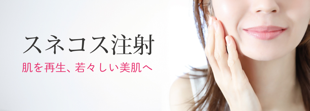 スネコス