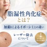 脂漏性角化症とは？加齢によるイボ・シミとの違いとエルビウムヤグレーザー除去について